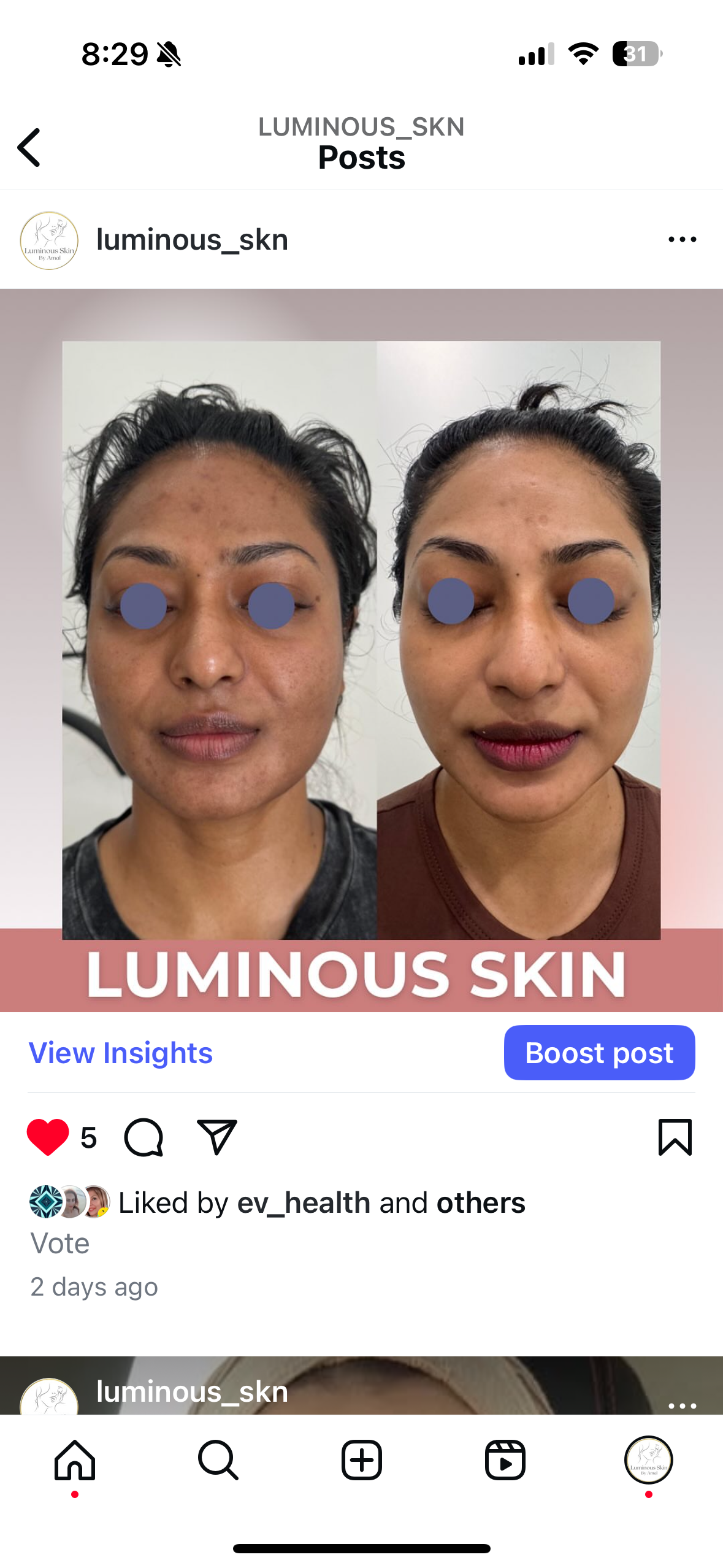 LIFT Brighten &amp; Tighten Package