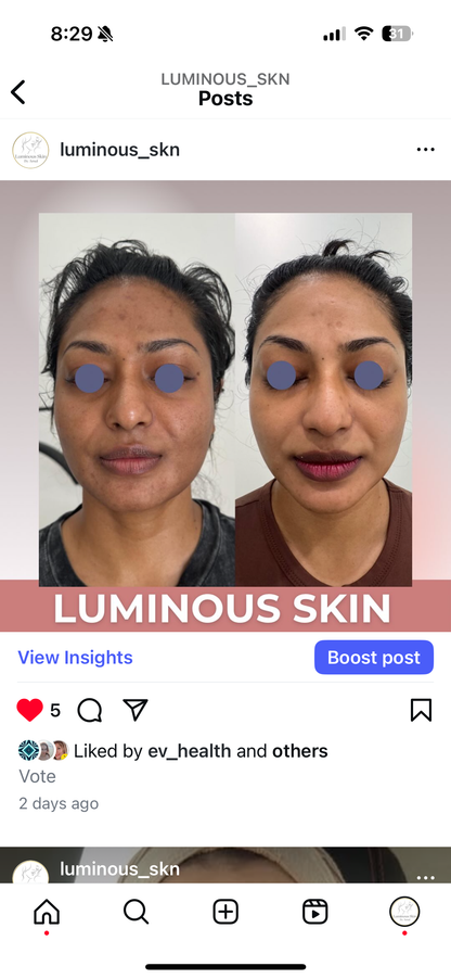 LIFT Brighten &amp; Tighten Package
