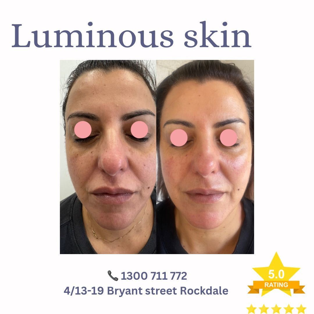 LIFT Brighten &amp; Tighten Package