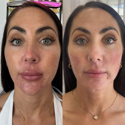 LIFT Brighten &amp; Tighten Package